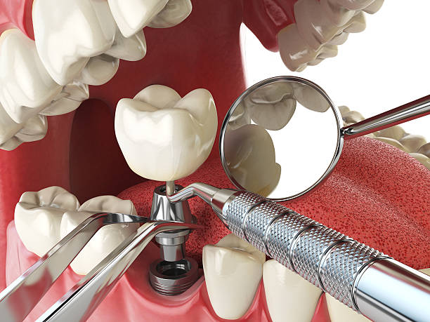 Best Emergency Dental Extractions in Orlinda, TN